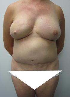 less_cropped_shaded.jpg less_cropped_shaded.jpg